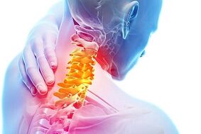 Síntomas da osteocondrose do pescozo e as regras nutricionais das enfermidades