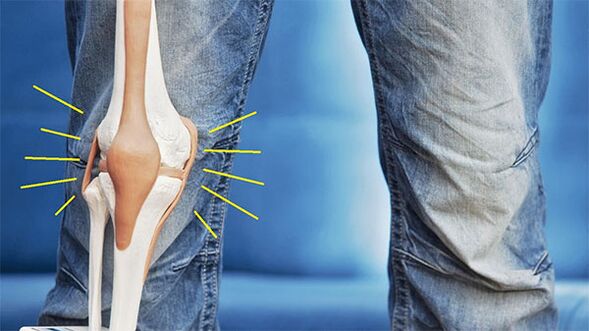 Dor na articulación do xeonllo