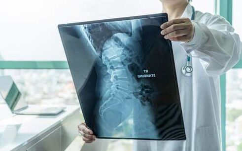A radiografía é un método de diagnóstico necesario cando doe as costas